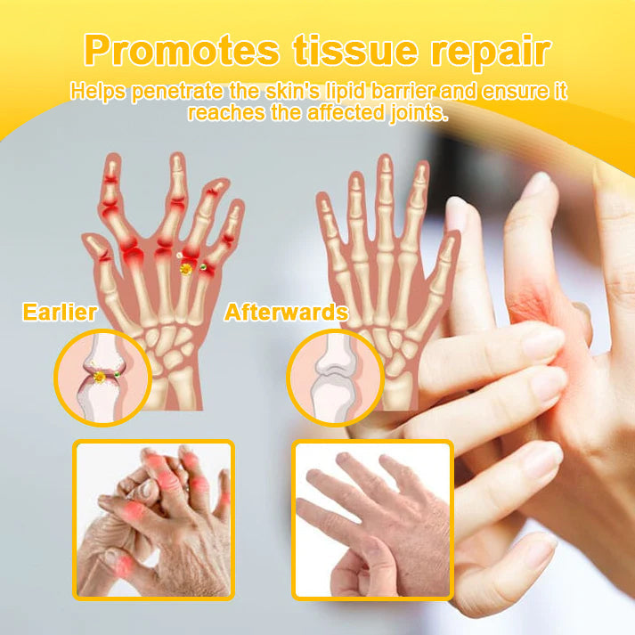 đFlash Sale - ODALIT⢠Botulinum Toxin & Bee Venom Pain-Relief Bone Healing Cream