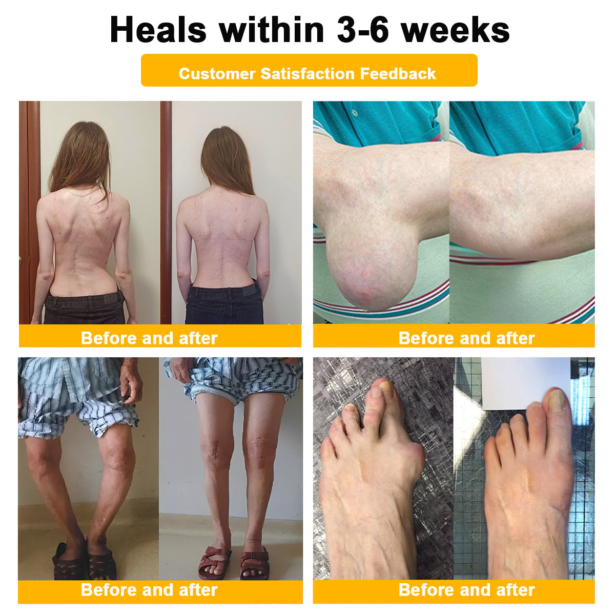 đFlash Sale - ODALIT⢠Botulinum Toxin & Bee Venom Pain-Relief Bone Healing Cream