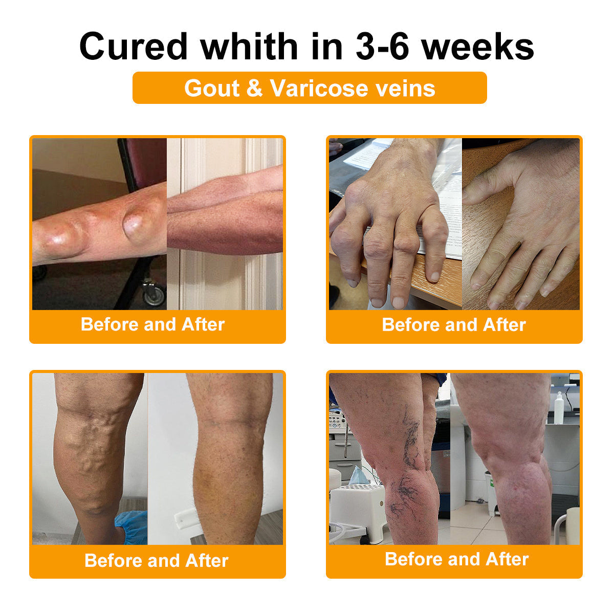 đFlash Sale - ODALIT⢠Botulinum Toxin & Bee Venom Pain-Relief Bone Healing Cream