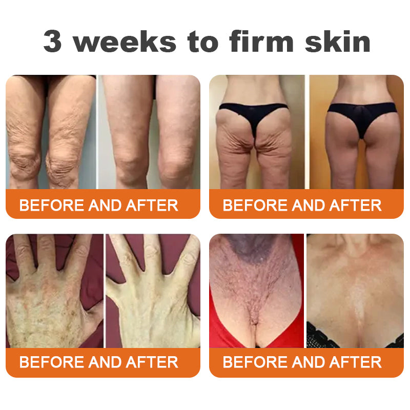đSeurico⢠Instant Wrinkle-Free Bee Toxin Cream | FINAL HOURS â 80% FLASH SALE!