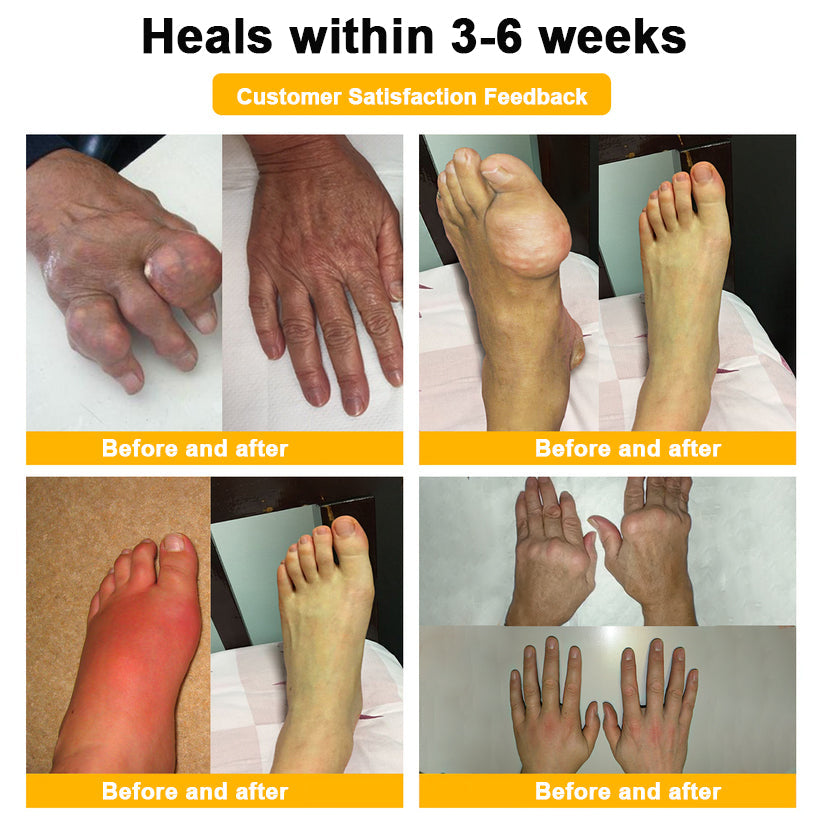 đFlash Sale - ODALIT⢠Botulinum Toxin & Bee Venom Pain-Relief Bone Healing Cream