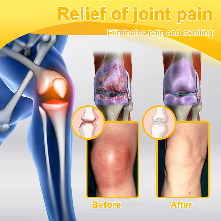 đFlash Sale - ODALIT⢠Botulinum Toxin & Bee Venom Pain-Relief Bone Healing Cream