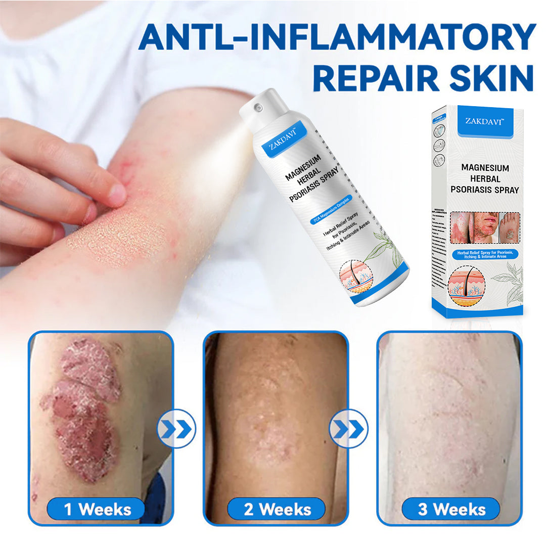 ✅Official Store: Zakdavi™ Magnesium Herbal Psoriasis Spray – FDA Certified Relief for Psoriasis, Eczema & Skin Tags