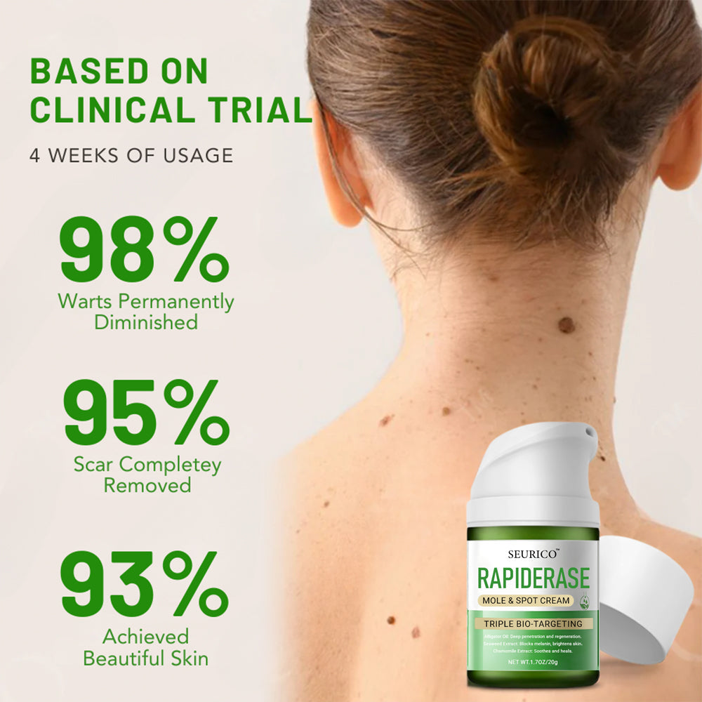 ✅ Official Store: Seurico™ RapidErase Mole & Spot Cream