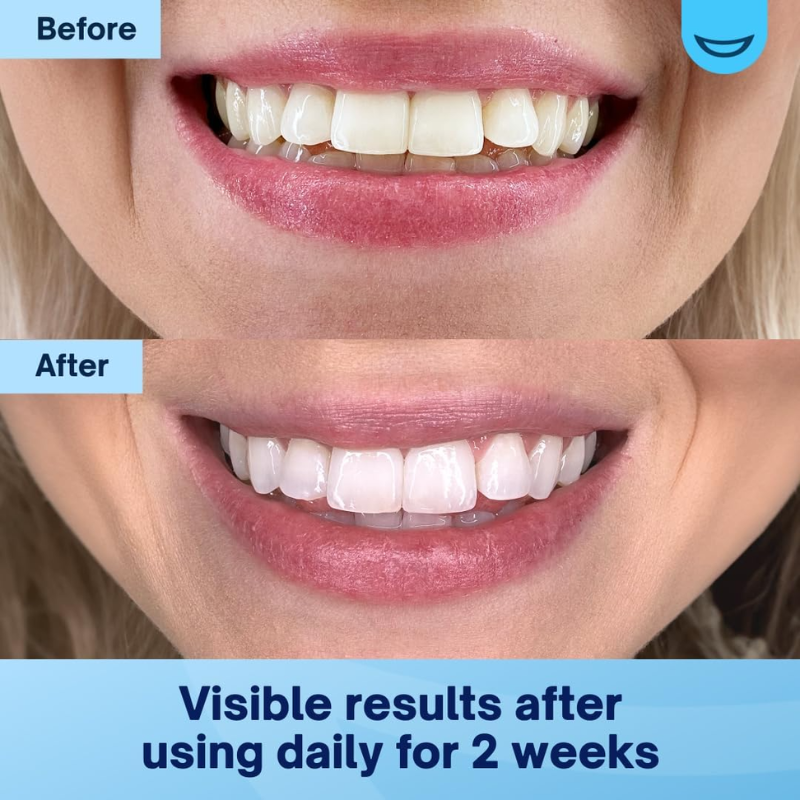 TeethRestoration Mineral Whitening & Repair Powder 🦷 (ADA Recommended)