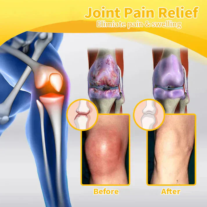 ✅ Negusy™ Lidocaine Scar-Free Pain Relief Liquid – AAOS Approved 👨‍⚕️ Reduces Joint Pain, Swelling & Stiffness