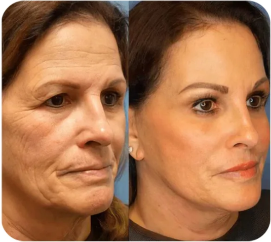 Seurico™ Firming Effect Makeup Base – Tighten, Hydrate & Brighten Instantly
