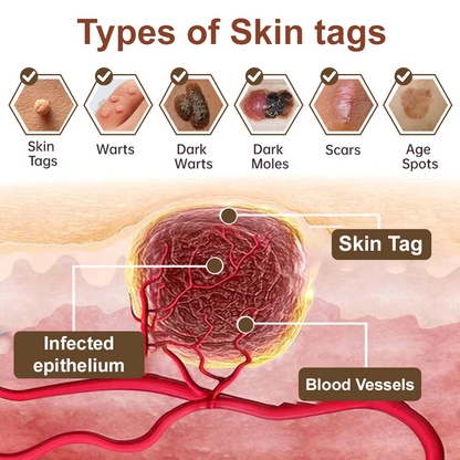 Seurico™ Black Rice Skin Repair Cream ⚕️ FDA Certified – Targets Warts, Psoriasis & Pigmentation