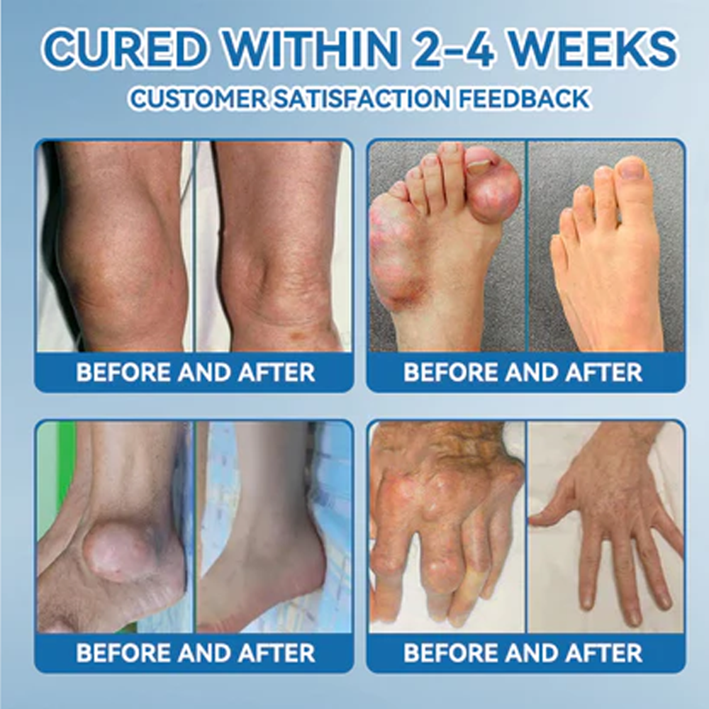 LBMLBM™ BPC-157 Joint Healing Cream  FDA Certified (Targets arthritis, nerve pain, rheumatism & sports-related stiffness for better mobility)