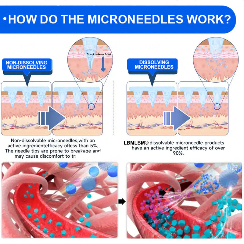 🔥Official Store | LBMLBM® SMGT-GLP-1 Nano Microneedle Patch with Collagen & Motrixyl 3000 | Targeting Obesity, Cardiovascular Disease, Diabetes, Sleep Apnea, Joint Issues & More
