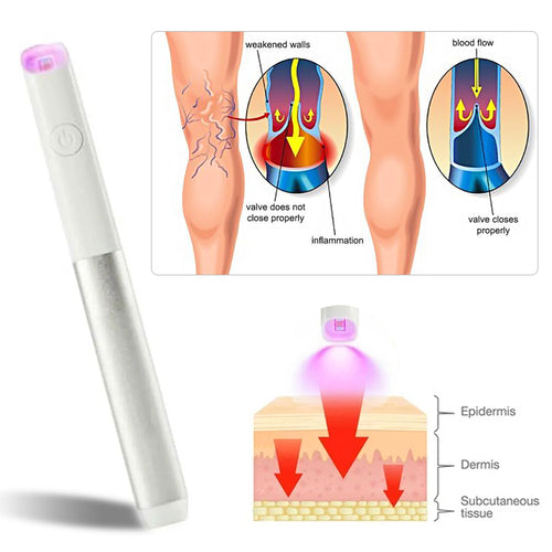 Seurico™ Red and Blue Light Therapy Pen for Varicose Veins Removal