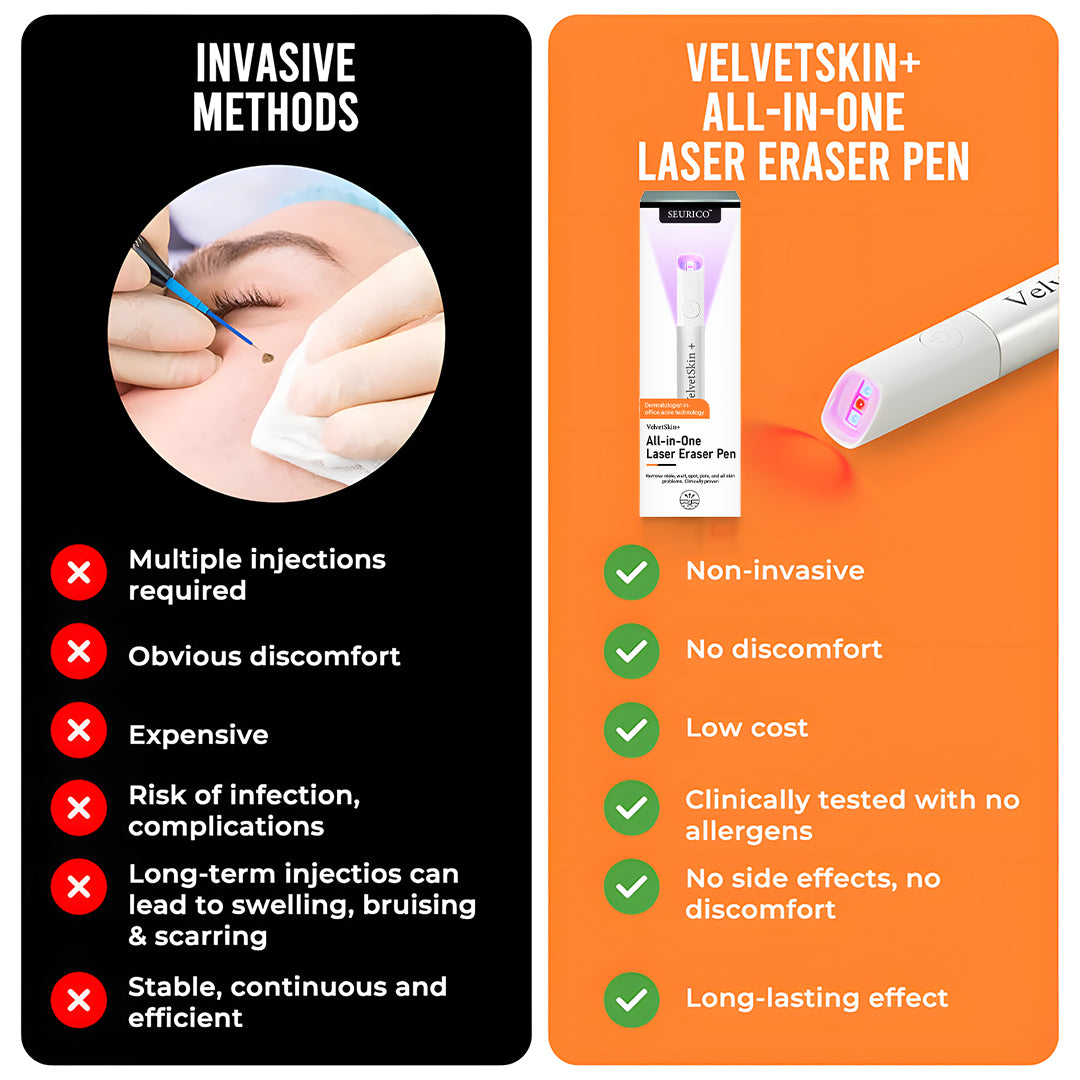Seurico™ VelvetSkin+ Laser Eraser Pen | Non-Invasive Removal for Moles & Warts