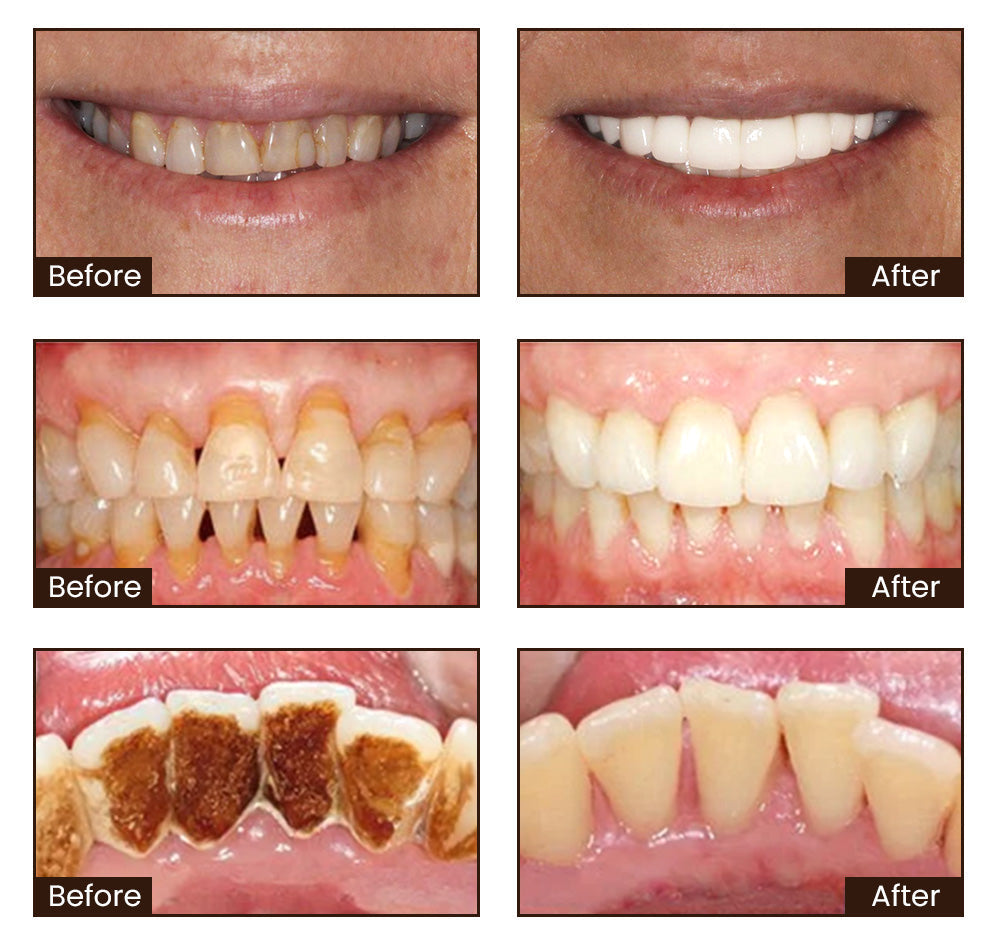 Seurico™ Natural Mineral Repair & Whitening Toothpaste