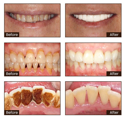 Seurico™ Natural Mineral Repair & Whitening Toothpaste