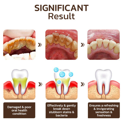 Seurico™ Natural Mineral Repair & Whitening Toothpaste