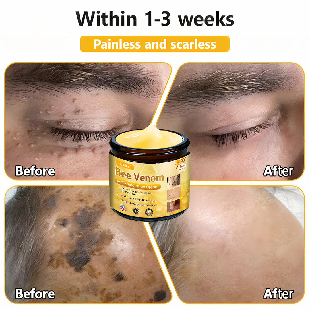 ✨ ODEIUN™ Bee Venom Skin Restoration Cream - Revitalize & Renew Your Skin Naturally! 🌿🐝