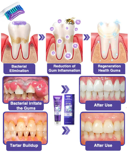 ODEIUN™ Bee Venom Dental Treatment Toothpaste