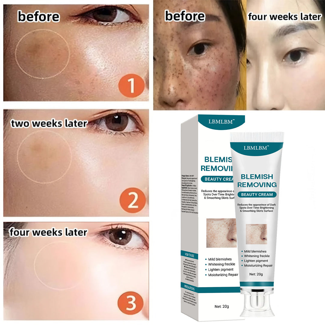 ✨ [Official Store] LBMLBM™ Blemish Removing Beauty Cream – Fade Dark Spots, Freckles & Wrinkles 💫 Restore a Radiant, Even-Toned Glow!