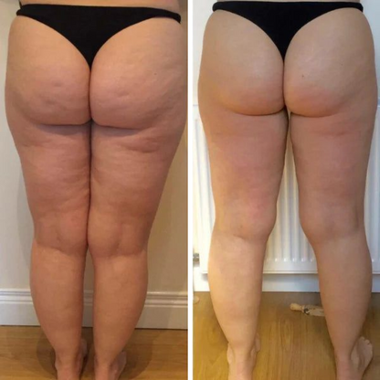 Negusy™ PDRN-GLP-1 Microneedle Slimming & Sculpting Gel