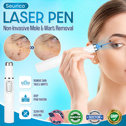 ✨Seurico™ Laser Pen - Non-invasive Mole and Wart Removal