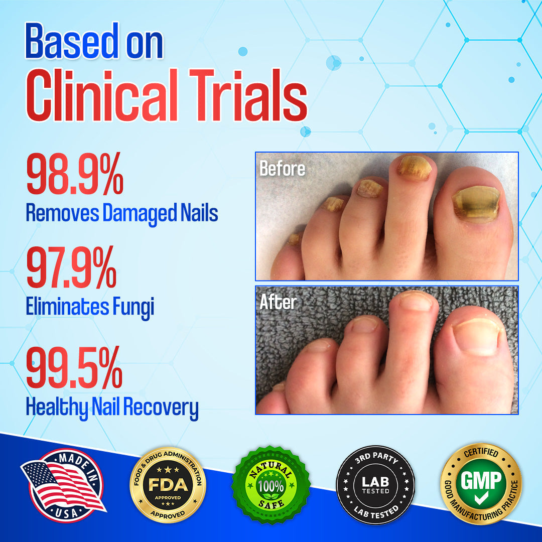 Zakdavi™ Anti-Fungal Nail Repair Patches — Say Goodbye to Nail Fungus in Days! 💅