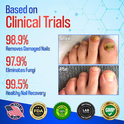 Zakdavi™ Anti-Fungal Nail Repair Patches — Say Goodbye to Nail Fungus in Days! 💅