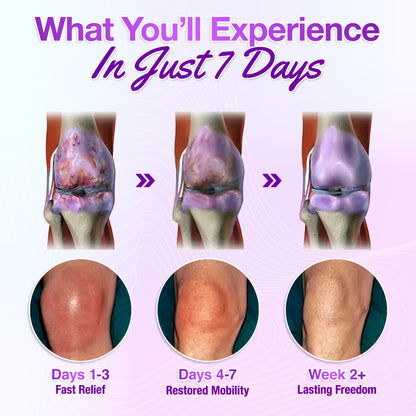 Seurico™ Joint Rescue Gel – Turmeric & Emu Oil Formula for 7-Day Pain Relief