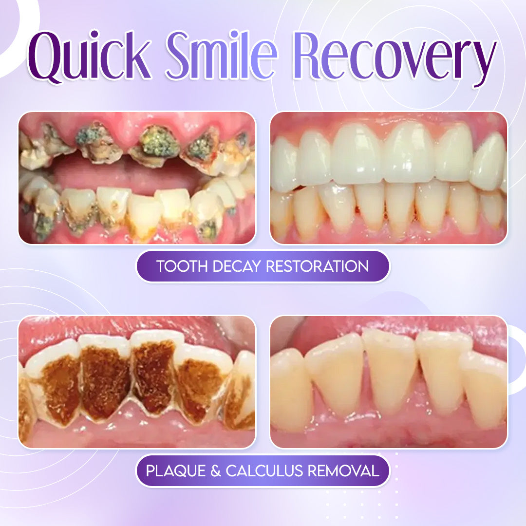 TeethRestoration Mineral Powder🦷(ADA recommended) 🎁Flash Sale - Don’t Miss Out