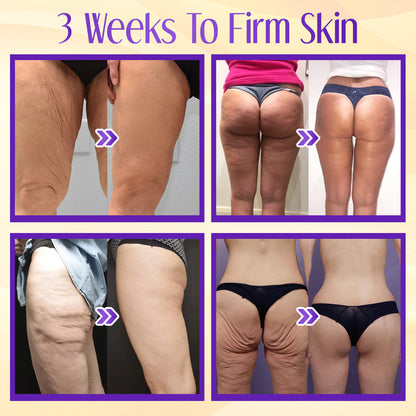 ✨ ODEIUN™ Queen Nectar Peptide + Bakuchiol Cream – Anti-Aging, Firming & Hydrating 🌸