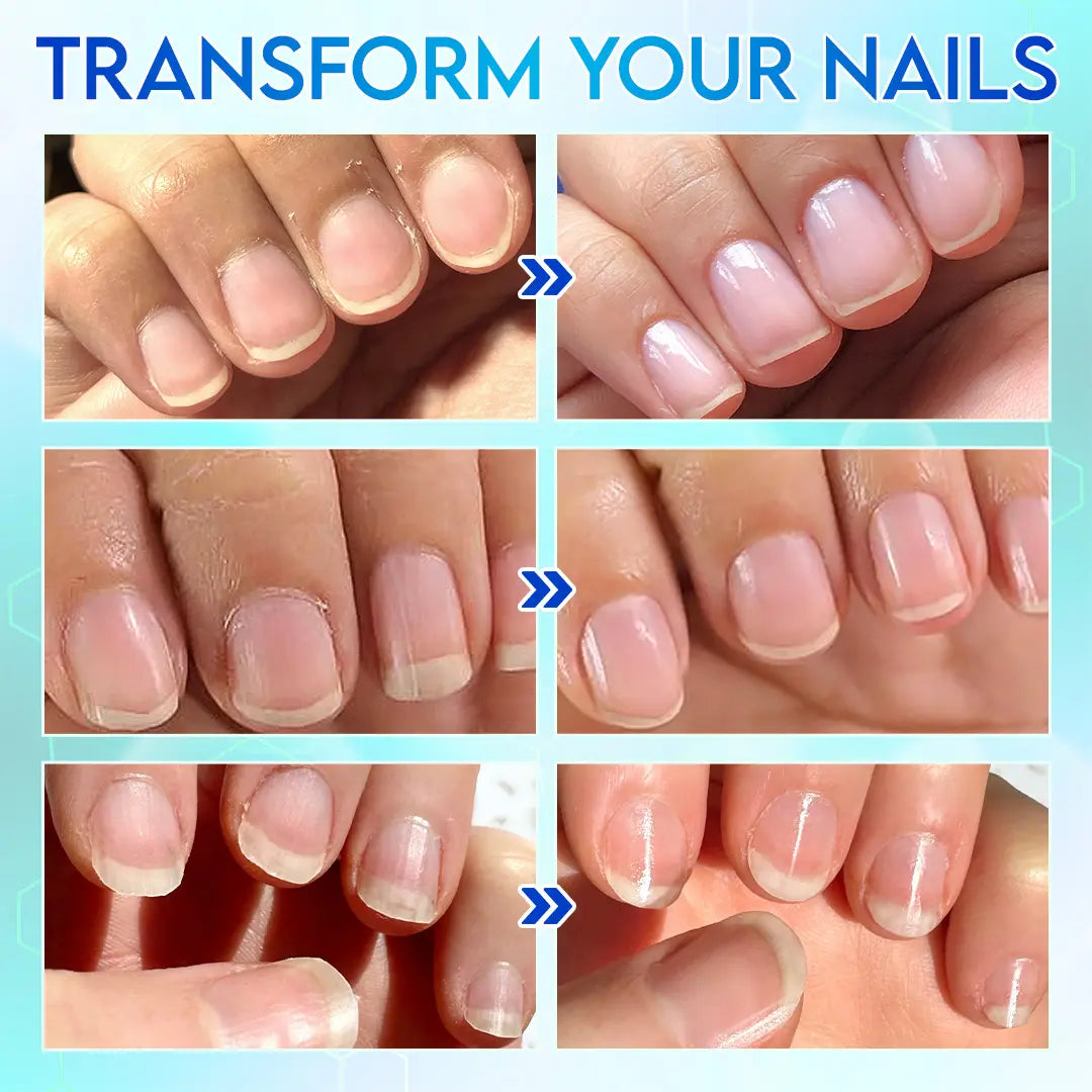 💅✨Universal Automatic Fingernail Grinder for Adults and Children👶