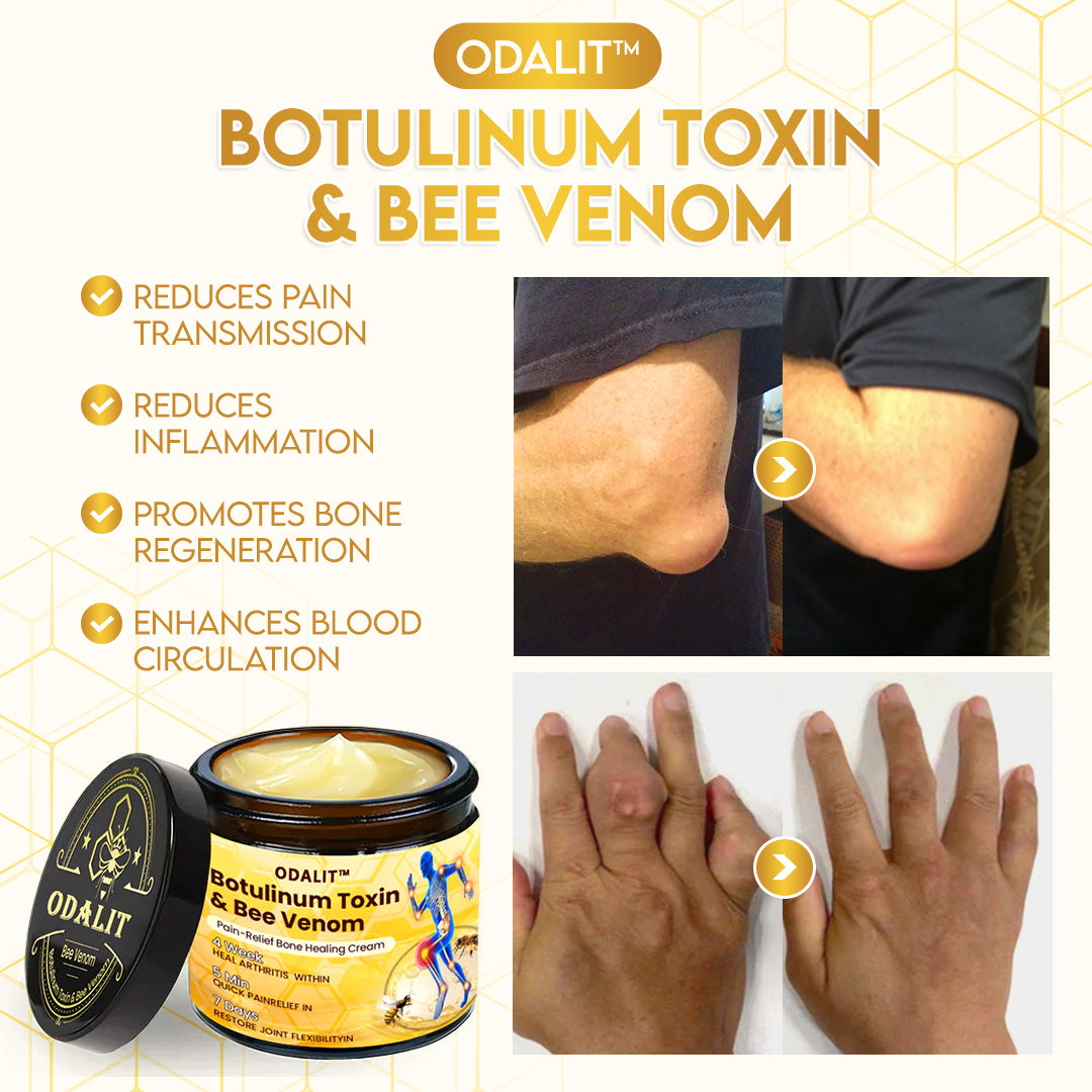 🎁Flash Sale - ODALIT™ Botulinum Toxin & Bee Venom Pain-Relief Bone Healing Cream