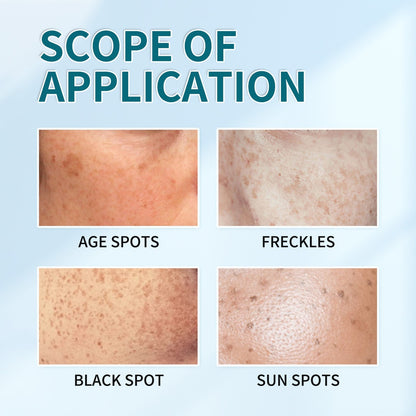 ✨ [Official Store] LBMLBM™ Blemish Removing Beauty Cream – Fade Dark Spots, Freckles & Wrinkles 💫 Restore a Radiant, Even-Toned Glow!