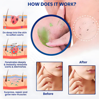 ✅ Official Store:  Seurico™ RapidErase Mole & Spot Cream