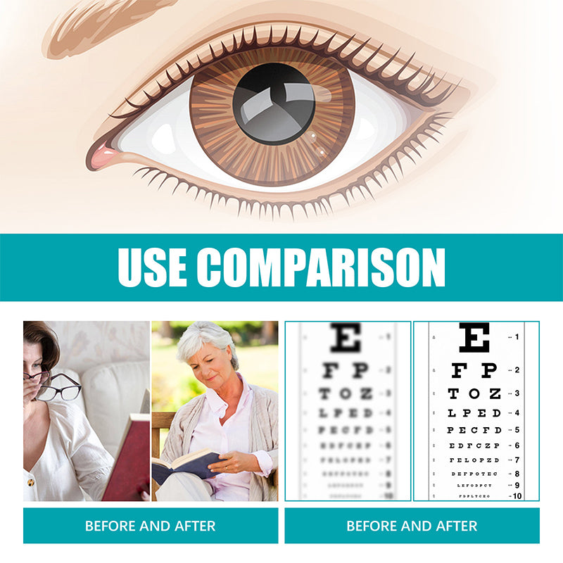 Optixa™ Cataracts Vision Enhancement Acupressure Patch