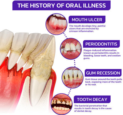 ODEIUN™ Bee Venom Dental Treatment Toothpaste